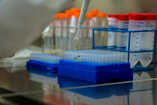 Fisabio y la Universitat Jaume I de Castelló buscan colaboración para investigar el síndrome de Smith-Lemli-Opitz (SLOS) Fisabio y la Universitat Jaume I de Castelló buscan colaboración para investigar el síndrome de Smith-Lemli-Opitz (SLOS)