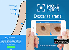 Descarga la APP Molexplore, para ayudar a la detección precoz del melanoma