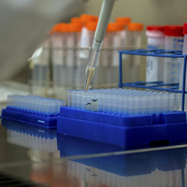 Fisabio y la Universitat Jaume I de Castelló buscan colaboración para investigar el síndrome de Smith-Lemli-Opitz (SLOS)